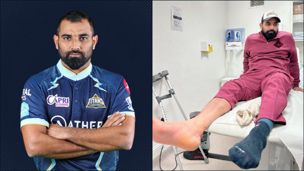 क्या मोहम्मद शमी IPL 2024 खेलेंगे Mohammad Shami injury Letest update today in hindi